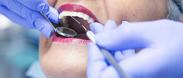 Best Emergency Care for Gum Disease in Key Center, WA